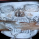 Illustration for article titled This Woman Had a Live Fragmentation Grenade Stuck Inside Her Face